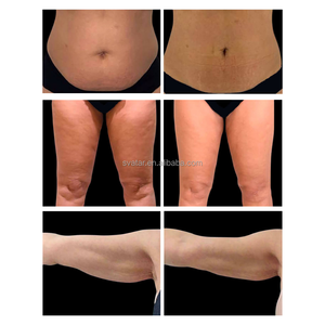 Máquina de Terapia Térmica para Tonificar el Cuerpo, Eliminar Grasa, Reafirmar la Piel y Rejuvenecer, con 4 Manijas - Product Image 4