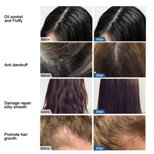Shampooing hydratant aux fruits naturels anti-frisottis et contrôle de la croissance des <span class=keywords><strong>cheveux</strong></span> pour <span class=keywords><strong>cheveux</strong></span> <span class=keywords><strong>bouclés</strong></span> - Product Image 3