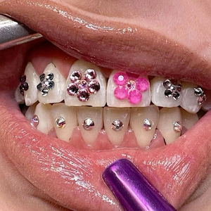 Ensemble de pierres précieuses pour dents en cristal transparent de couleur métallique en gros, kit de pierres précieuses pour dents avec lumière violette - Product Image 1