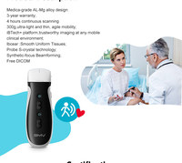 Dispositivo de imagen inteligente lineal cardíaco de matriz en fase Doppler de color de alta calidad 192 elementos WiFi ultrasonido inalámbrico