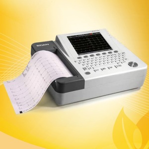 เครื่องบันทึกคลื่นไฟฟ้าหัวใจดิจิทัล Mindray Se-1200 Express 12 ลีด พร้อมแบตเตอรี่ในตัว สำหรับการวินิจฉัยทางคลินิกและการวิจัย - Product Image 2