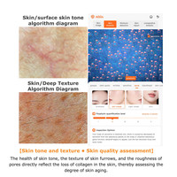 Sistema Profesional de Análisis de Acné con IA de 8MP para Salones de Belleza, Revela la Actividad Bacteriana con la Solución Pro MedSpa