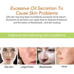 Mascarilla Facial de Arcilla para el Cuidado de la Piel, 120g, Limpieza Profunda, Purifica los Poros, Mascarilla Facial de Cúrcuma - Product Image 3