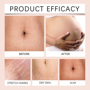 Vente en gros Best-seller Crème anti-vergetures escargot pour estomper ridules et cicatrices, lisser la peau et offrir des soins doux - Product Image 2