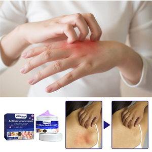 <span class=keywords><strong>Crème</strong></span> antibactérienne de marque privée mains pieds anus démangeaisons <span class=keywords><strong>eczéma</strong></span> soulageant la fleur pourpre lilas peau <span class=keywords><strong>crème</strong></span> antiprurigineuse - Product Image 3