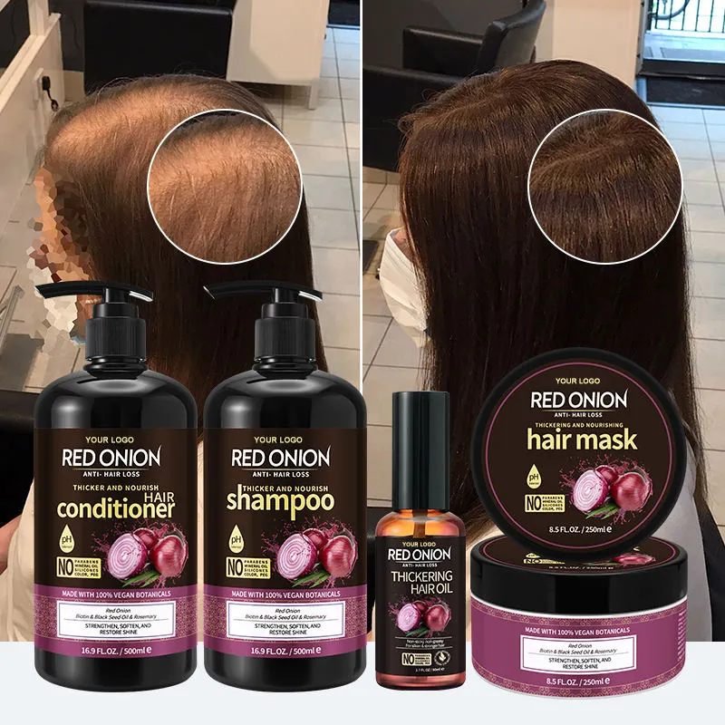 OEM 100% Naturel Réparation Formulé Cheveux Shampooing Renforçant L'oignon Rouge Anti Chute De Cheveux Shampooing Ensemble Pour Favoriser La Croissance Des Cheveux