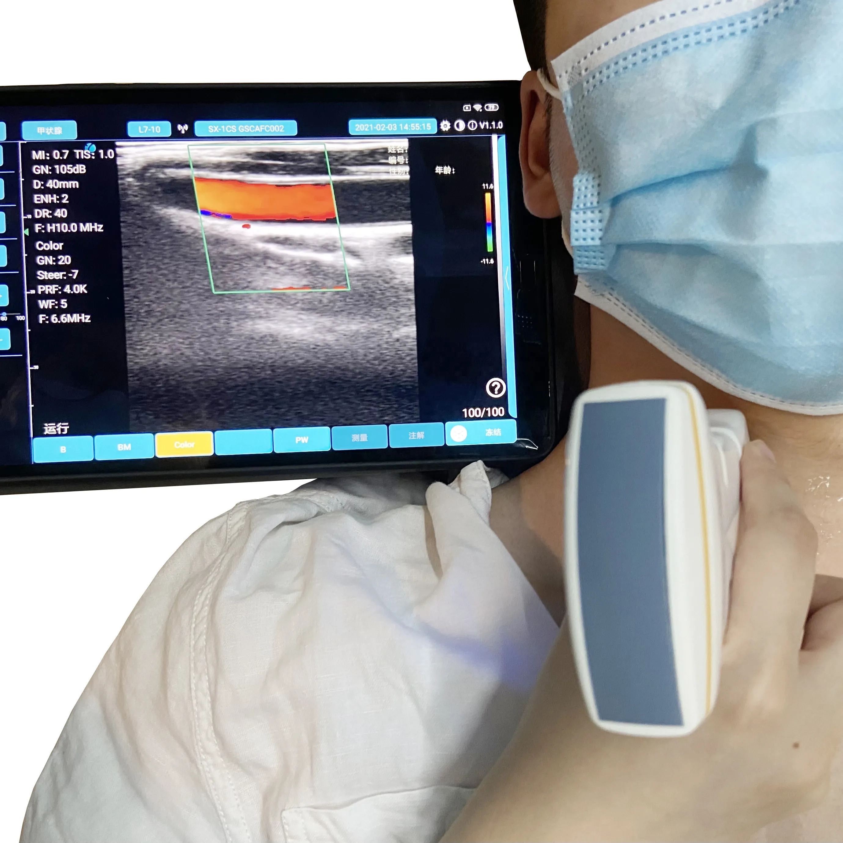 Новый стиль 128 элементов двойная головка цветной допплер Мини Wi-Fi Ручной Беспроводной ультразвуковой зонд медицинские ультразвуковые инструменты