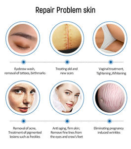 Nouveau produit : Appareil de beauté 2-en-1 laser CO2 fractionné + machine de soin cutané 10600nm sur pied pour le traitement des taches de rousseur - Product Image 3