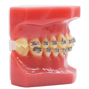 Gelsonlab HSDT-B6-02 Dental Kieferorthopädische Metall <span class=keywords><strong>Brcket</strong></span> mit Typodont Zähne Modell - Product Image 3