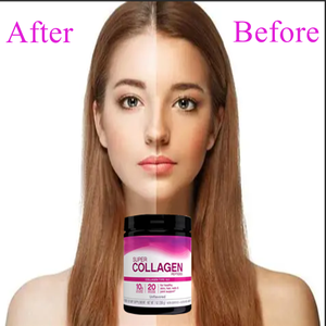 Sağlık cilt saç çivi ve eklem sağlık desteği için Prebiotic ile <span class=keywords><strong>OEM</strong></span> süper kollajen tozu - Product Image 3