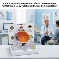 Modelo de Ojo Anatómico Premium de PVC, 3 Partes, 3D, con Cataratas, para Enseñanza, Diseño Desmontable de 3 Partes