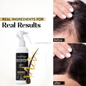 Spray capillaire premium à l'eau de riz pour la croissance des <span class=keywords><strong>cheveux</strong></span>, nourrissant le cuir chevelu, réparant les <span class=keywords><strong>cheveux</strong></span> et fortifiant les racines (Marque Blanche) - Product Image 4