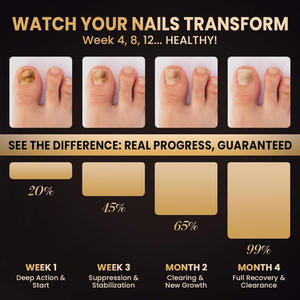 All'ingrosso <span class=keywords><strong>per</strong></span> la cura delle <span class=keywords><strong>unghie</strong></span> idratante antifungina Anti pelle morta Anti puntura idratante <span class=keywords><strong>per</strong></span> la nutrizione delle <span class=keywords><strong>unghie</strong></span> penna - Product Image 5