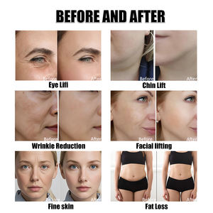 持ち運び可能なフェイシャルマシン、顔のリフトアップ、肌の引き締め、しわ防止＆肌の若返り美容機器 - Product Image 5