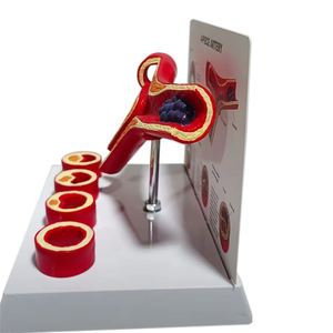 Anatomía humana 4 etapas Arteria y vasos sanguíneos <span class=keywords><strong>Medicina</strong></span> Patología trombo modelo - Product Image 1