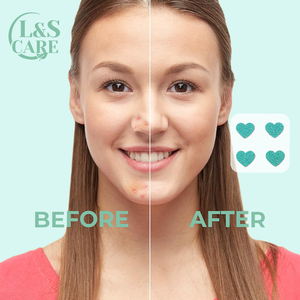 4 toppe colorate <span class=keywords><strong>Per</strong></span> foglio a forma di cuore brufolo di <span class=keywords><strong>Acne</strong></span> Patch con custodia in plastica con specchio - Product Image 6