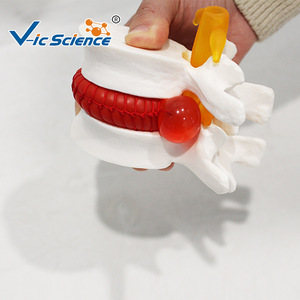 Modelo de demostración de hernia de disco lumbar, esqueleto vertebral espinal médico, material didáctico de patología, venta al por mayor desde - Product Image 2