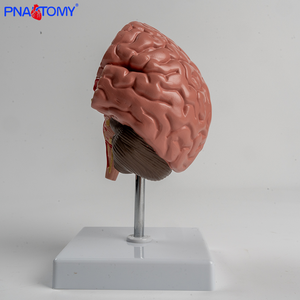 Modelo Anatômico do Cérebro PVC Hemorragia Cerebral e Malformação Arteriovenosa Patologia - Product Image 4