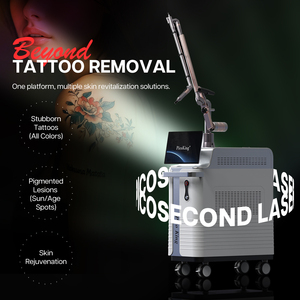 Machine économique de suppression de tatouages au <span class=keywords><strong>laser</strong></span> picoseconde, offrant un excellent rapport qualité-prix, idéale pour les nouvelles entreprises et les salons de beauté en démarrage. - Product Image 4