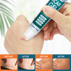 Gel al Silicone per Cicatrici, Formula Cosmetica Avanzata, Cura Idratante per Cicatrici da Acne, Smagliature, Cicatrici da C-Section e Ustioni - Product Image 1