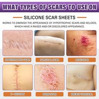 Patch cicatriciel en silicone pour le traitement des cicatrices Bandes de cicatrices réutilisables pour la chirurgie, la section C, les vergetures chéloïdes, l'élimination des cicatrices d'acné