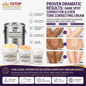 Crema para Eliminar Pecas <span class=keywords><strong>King</strong></span> Freckle, Aclara la Piel, Mejora la Opacidad, Crema Blanqueadora para Eliminar Pecas, Productos Terminados al por Mayor - Product Image 3