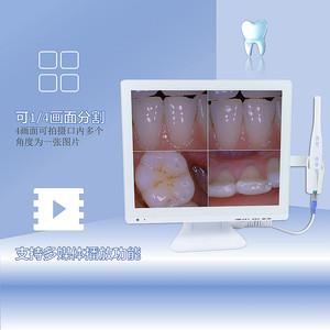 Sistema de Endoscopia Dental con Monitor de 17 Pulgadas, 800W Píxeles, Equipo Médico de Observación Oral - Product Image 1