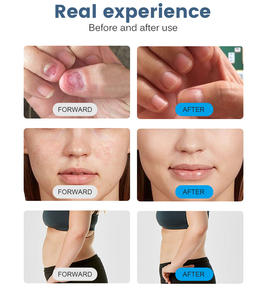 Equipo de fisioterapia con láser de diodo 6 en 1 de 980nm para rejuvenecimiento de la piel y tratamiento de hongos en las uñas. - Product Image 6