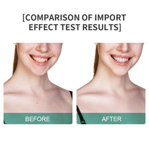 เครื่องยกกระชับผิวหน้าและลำคอ ลดริ้วรอยด้วยไมโครเคอร์เรนท์ สำหรับใช้ในบ้าน ชาร์จผ่าน USB รองรับหลายปลั๊ก - Product Image 4