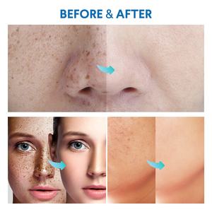 <span class=keywords><strong>Crema</strong></span>/Serum OEM <span class=keywords><strong>de</strong></span> Marca Privada para Eliminar Manchas Oscuras y Protuberancias <span class=keywords><strong>de</strong></span> Afeitado, para Vellos Encarnados, Foliculitis y Quemaduras <span class=keywords><strong>de</strong></span> Afeitado - Product Image 6