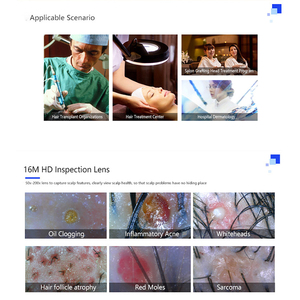 Máquina de Análisis Capilar con Material ABS, Detecta Folículos Pilosos y Atrofia Capilar para Salón de Belleza y Uso Doméstico - Product Image 2