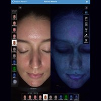 Luz UV/lámpara de madera Análisis y predicción de la piel facial Máquina hecha en China