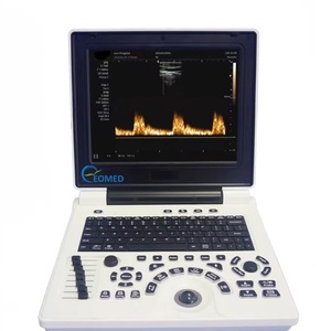 Échographe portable pour usage hospitalier BW20, appareil d'échographie entièrement numérique avec PW - Product Image 1