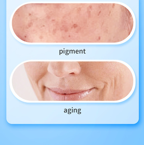 Analizador Portátil de Ingredientes para el Cuidado de la Piel Dermatológico, Analiza Profesionalmente el Acné y la Pigmentación. - Product Image 4