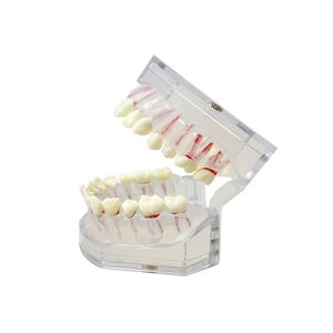 Modelo Dental de Alta Calidad, Modelo de Práctica de Enseñanza de Raíces Dentales, Desmontable, para Demostración de Dentistas, Entrenamiento de Estudiantes, Laboratorio - Product Image 3