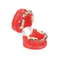 Modèles de dents anatomiques Fultone pour études orthodontiques et dentaires, conformes aux normes médicales