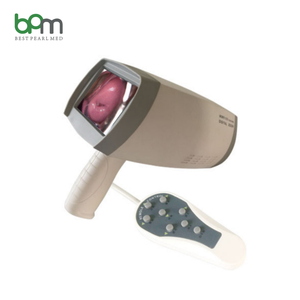 Máy soi cổ tử cung điện tử video <span class=keywords><strong>HD</strong></span> y tế dành cho phụ nữ, soi cổ tử cung trong phụ khoa - Product Image 1