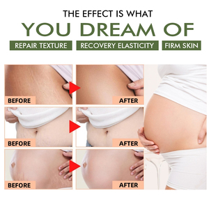 Crème Botanique Anti-Rides et Anti-Vergetures : Sûre pour les Mamans, Absorption Rapide, Lisse et Raffermit Visiblement la <span class=keywords><strong>Peau</strong></span> du Corps. - Product Image 3