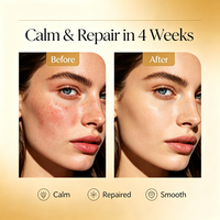 Produits de soin de la peau coréens en marque privée, sérum pour le visage à la niacinamide et à la vitamine C, acide hyaluronique, PDRN, sérum hydratant pour le visage, 100 ml