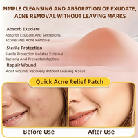 AUSLKA Star Patch Anti-Acné Physique, Patch Hydrocolloïde Doux Non Irritant, Fin et Respirant, Marque Privée, Lumière LED