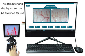 Xách tay <span class=keywords><strong>400X</strong></span> <span class=keywords><strong>USB</strong></span> kính hiển vi kỹ thuật số cho móng tay gấp mao mạch máu vi tuần hoàn quan sát - Product Image 3