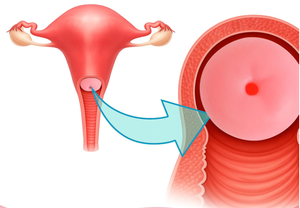 Modelo de Exhibición de Patología <span class=keywords><strong>Cervical</strong></span> Femenina para Ciencias Médicas, Niveles 1-6, Recursos Didácticos - Product Image 2