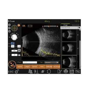 Ultrasonografía Ocular OAB-1000 Profesional a Precio Económico, Integración Multimodo, Fácil Operación para Laboratorio Óptico - Product Image 4