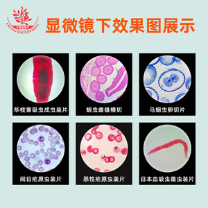 Dix lamelles de spécimens de parasites, spécimens classiques teintés pour l'enseignement supérieur et la recherche, spécimens de parasites clairs. - Product Image 4
