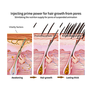 PURC – Spray <span class=keywords><strong>de</strong></span> croissance des <span class=keywords><strong>cheveux</strong></span> à effet rapide pour le traitement <span class=keywords><strong>de</strong></span> la perte <span class=keywords><strong>de</strong></span> <span class=keywords><strong>cheveux</strong></span>, huile <span class=keywords><strong>de</strong></span> croissance naturelle et biologique, sérum, marque privée - Product Image 4