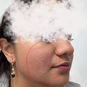 Set Professionale per SPA con Maschera Esfoliante in Polvere di Spicule di Spongilla e Alghe per Esfoliazione Profonda con Siero Riparatore al DNA di Salmone PDRN - Product Image 3