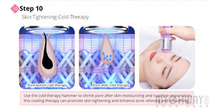 ماكينة التجميل SPA لسطح المكتب 9 في 1 3 ميجاهرتز غسول تقشير رقيق للغاية لإعادة شباب بشرة الوجه وعلاج حب الشباب - Product Image 4