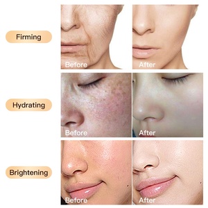 Ensemble de Soins de la Peau Anti-âge et Anti-rides au Collagène Naturel, Pur et Biologique, à l'Eau de Riz Coréenne, Marque Privée, <span class=keywords><strong>Vente</strong></span> en Gros - Product Image 3