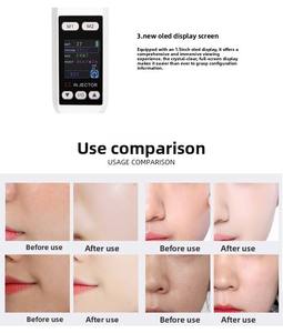 Pistolet à eau portable à pression négative, style tendance, instrument d'hydrothérapie à prix réduit pour usage domestique - Product Image 5