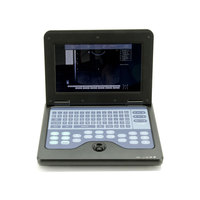 CONTEC CE Scanner à ultrasons numérique portable CMS600P2 Système de diagnostic à ultrasons B-Ultrasons Chine